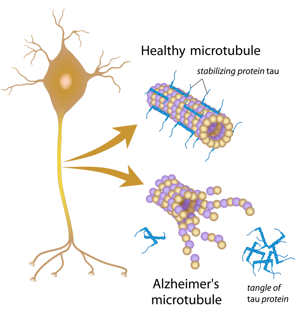 AD microtubule.jpg